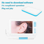 Endoscópio Visual C01 com Ecrã de 4,3 Polegadas HD1080P, Colher Auricular, 6 LEDs, Diâmetro: 3,9mm, C01 3,9mm