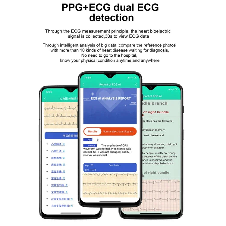 Relógio Inteligente E86 com Ecrã TFT Colorido de 1,7 polegadas, à Prova de Água IP68, Suporta Monitorização de Oxigénio no Sangue / Monitorização da Temperatura Corporal / Diagnóstico Médico por IA, Estilo: Correia de Aço, Correia de Aço (Preto)