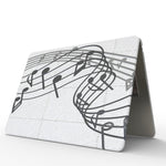 Capa Protetora Fosca para Portátil com Padrão Impresso UV, Para MacBook Air 13,6 2025 / 2022 / 2023, Para MacBook Pro 13,3 A2338/A2251/A2289/A2159