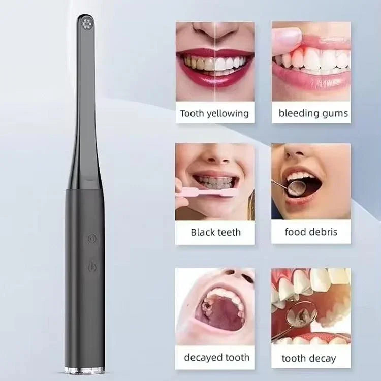 Instrumento Visual de Observação Oral FY-B800 Endoscópio Oral HD WiFi Sem Fios