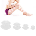 Conjunto de 4 Copos de Ventosa para Massagem Corporal, Terapia de Ventosaterapia, Anti-Celulite, Copos de Silicone a Vácuo