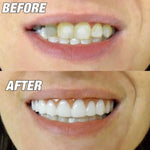 Aparelho de Clareamento Simulado em Silicone, Confortável e Flexível, Dentes Curvos, Ferramentas de Beleza para Dentaduras, Comprimento: 7cm