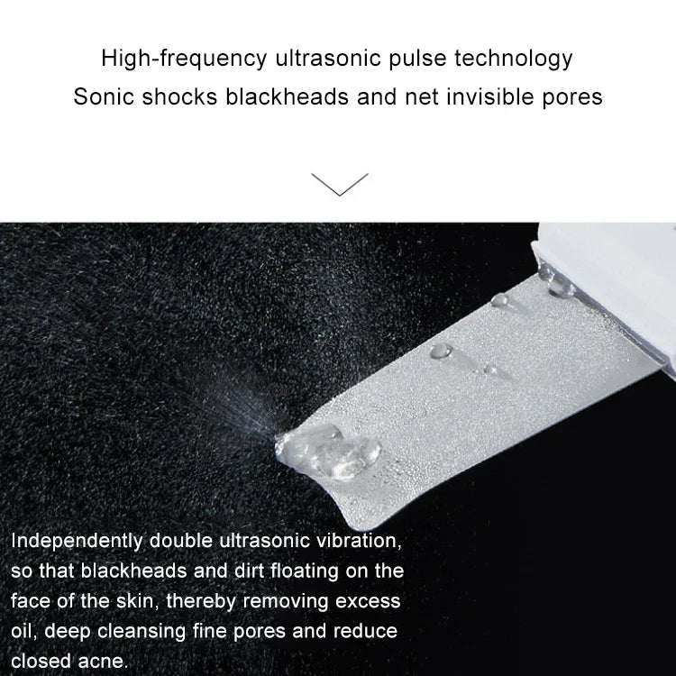 Máquina de Limpeza Facial por Vibração Ultrassónica 2W, Removedor de Pele Morta, Instrumento de Beleza Facial
