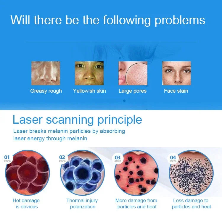 Máquina Portátil de Picosegundos para Remoção de Tatuagens, Sardas, Sinais, Caneta de Cuidados de Beleza a Laser Plasma, USB / Luz Azul, USB / Luz Vermelha