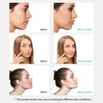 Xpreen Dispositivo Facial de Beleza Recarregável para Limpeza de Poros com Ecrã LED e 4 Sondas, XPRE111