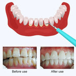 LSHOW YJK015A Polidor de Dentes Elétrico Doméstico à Prova de Água com Vibração de Alta Frequência, Modo de Cinco Velocidades, Carregamento USB 3.7V