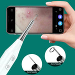 Endoscópio Supereyes Y009 Visual para Limpeza de Acne, Espelho Microscópico de Ampliação para Ouvido, Y009