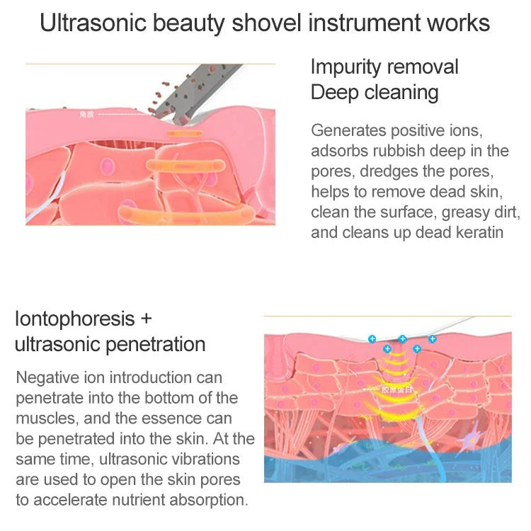 Máquina de Beleza Ultrassónica BLK-D016 para Pele, Instrumento de Massagem Facial Doméstico com Vibração