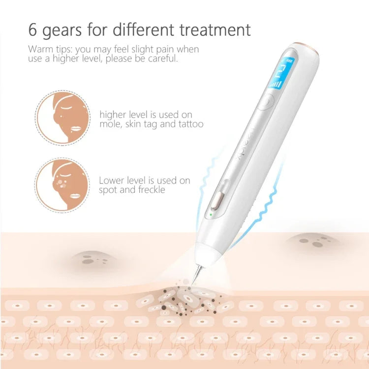 XPREEN XPRE051 Caneta Profissional Sem Fios Recarregável para Remoção de Sinais, Sardas, Manchas Escuras, Tatuagens e Verrugas, Apagador de Manchas com Ecrã LED e Holofote