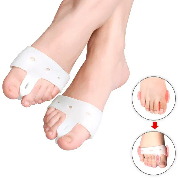 1 Par de Órteses Ortopédicas Especiais ZRWC27 para Hallux Valgus, ZRWC27