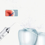 Escova Dental Elétrica com Jato de Água, Escalador Dentário Portátil para Casa, Branco, Rosa, Azul