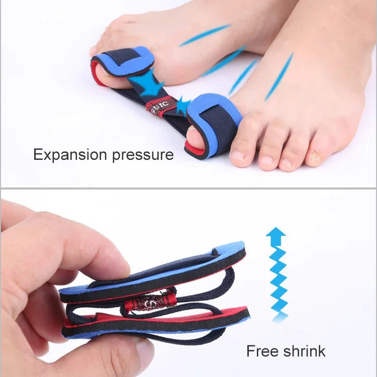 Ferramenta Profissional de Cuidados dos Pés Corretor de Joanete Protetor Ósseo do Dedão do Pé Endireitador de Hallux Valgus Separador de Dedos Pedicure