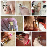 Ferramentas de Cuidados para Unhas Encravadas Pedicure Corretor de Joanetes para Dedos