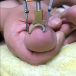 Ferramentas de Cuidados para Unhas Encravadas Pedicure Corretor de Joanetes para Dedos