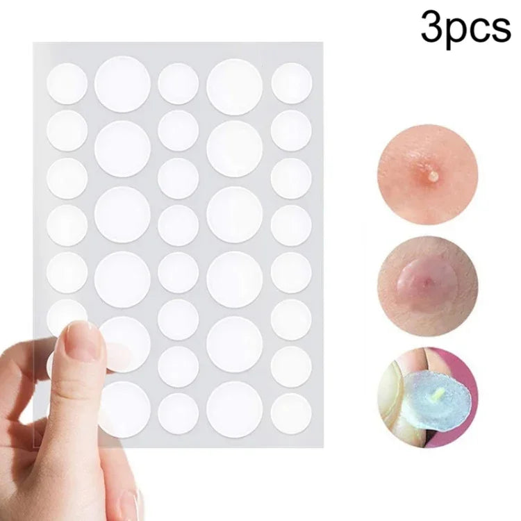 Conjunto de 3 Ferramentas para Tratamento de Acne, Cicatrizes de Acne e Borbulhas, Adesivos