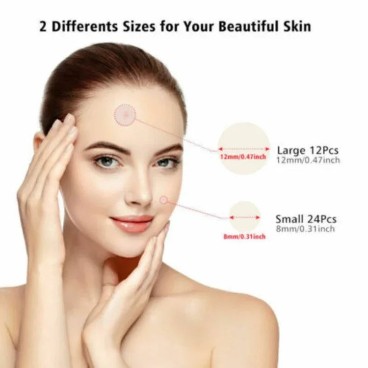 Conjunto de 3 Ferramentas para Tratamento de Acne, Cicatrizes de Acne e Borbulhas, Adesivos