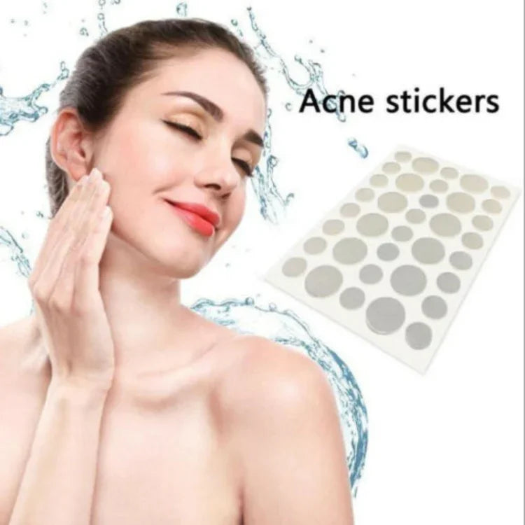 Conjunto de 3 Ferramentas para Tratamento de Acne, Cicatrizes de Acne e Borbulhas, Adesivos