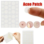 Conjunto de 3 Ferramentas para Tratamento de Acne, Cicatrizes de Acne e Borbulhas, Adesivos