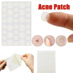 Conjunto de 3 Ferramentas para Tratamento de Acne, Cicatrizes de Acne e Borbulhas, Adesivos