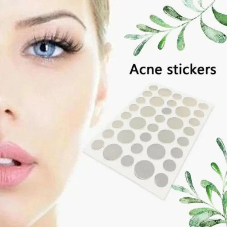 Conjunto de 3 Ferramentas para Tratamento de Acne, Cicatrizes de Acne e Borbulhas, Adesivos