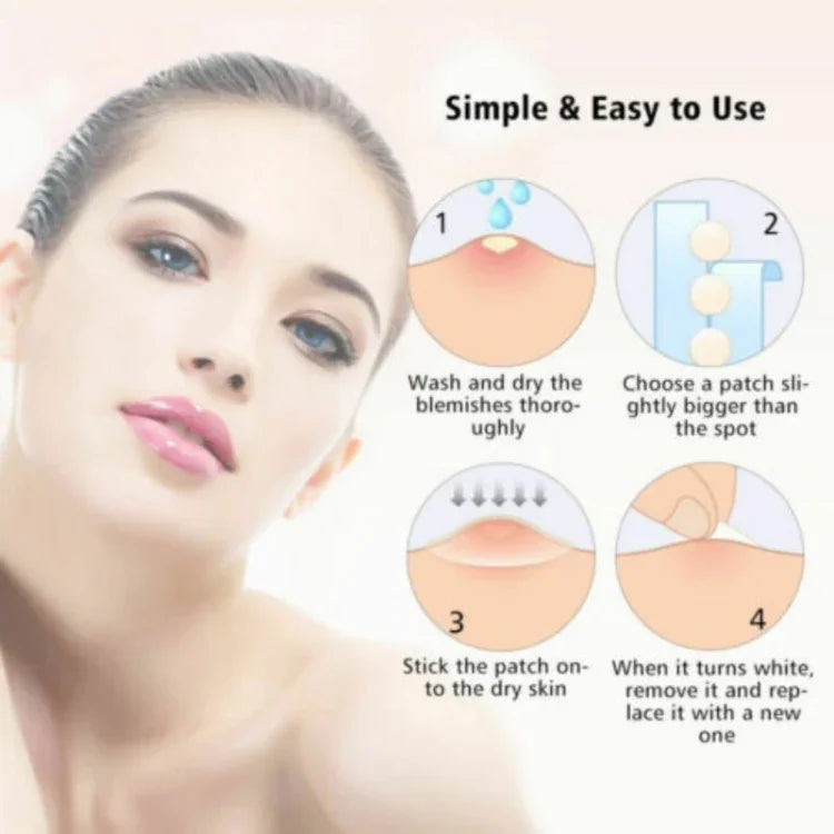Conjunto de 3 Ferramentas para Tratamento de Acne, Cicatrizes de Acne e Borbulhas, Adesivos