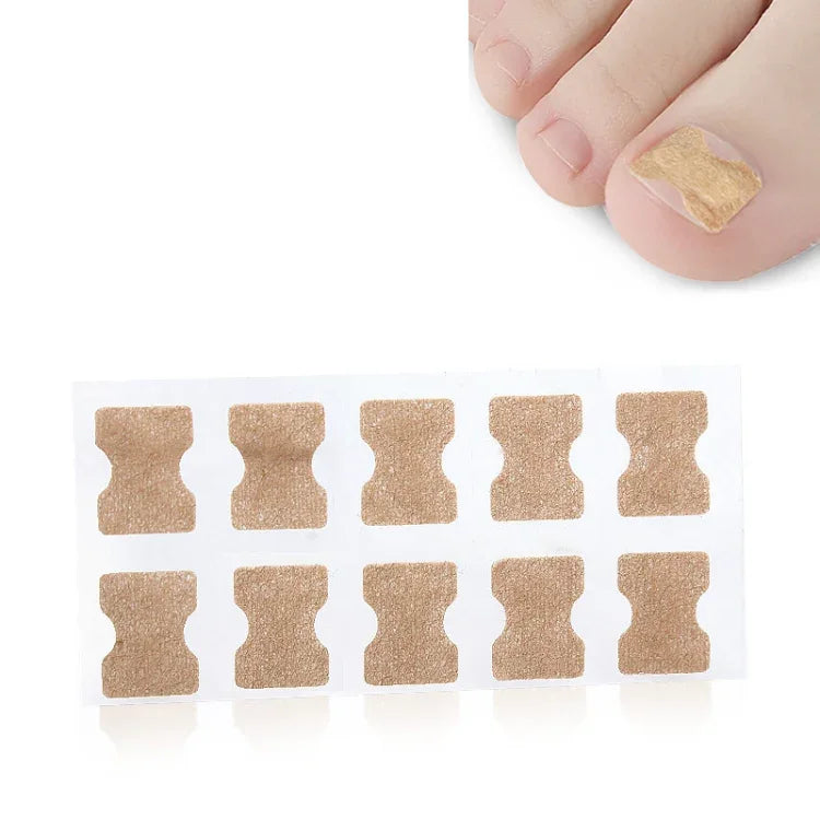 10 UN Corrector ortopédico para unha do pé sem cola, inserção para sulco da unha do pé, fundo transparente, fundo branco, fundo azul
