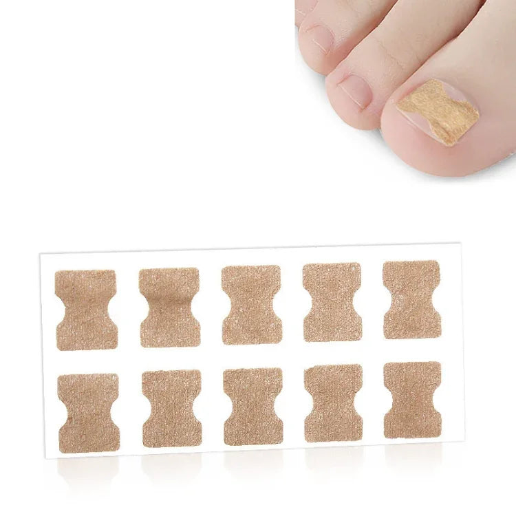 10 UN Corrector ortopédico para unha do pé sem cola, inserção para sulco da unha do pé, fundo transparente, fundo branco, fundo azul
