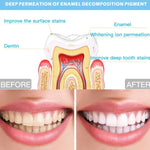 Dispositivo de Clareamento Dentário com 16 LEDs Temporizador de 25min Controlado por Fio, Controlado por Fio