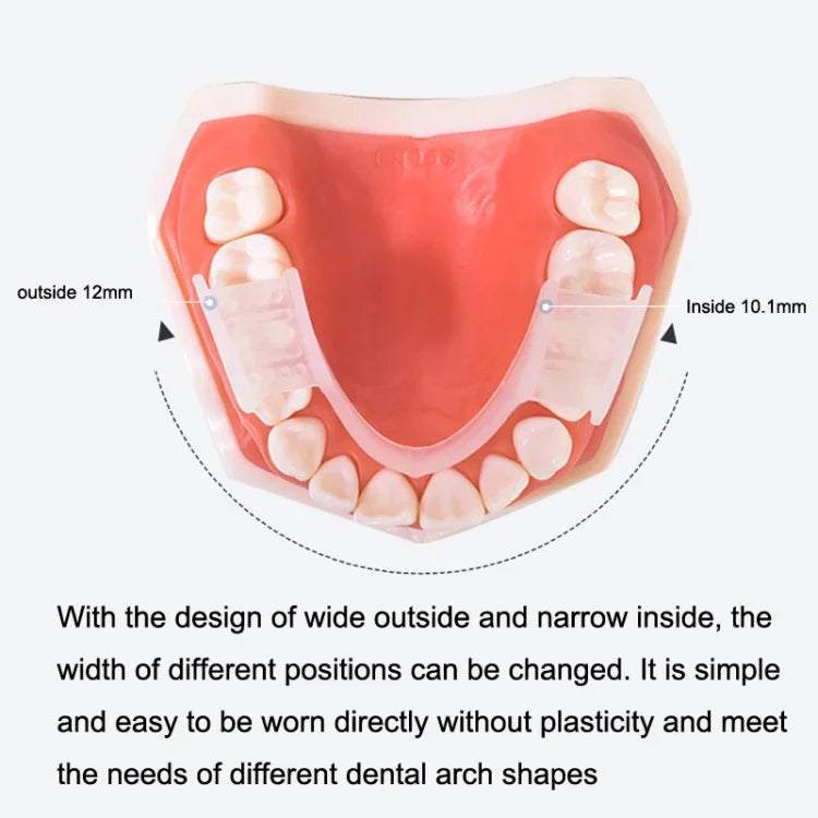 Aparelho Ortodôntico de Silicone Y-Kelin Simulação de Aparelho Anti-Molar para Noite, Transparente