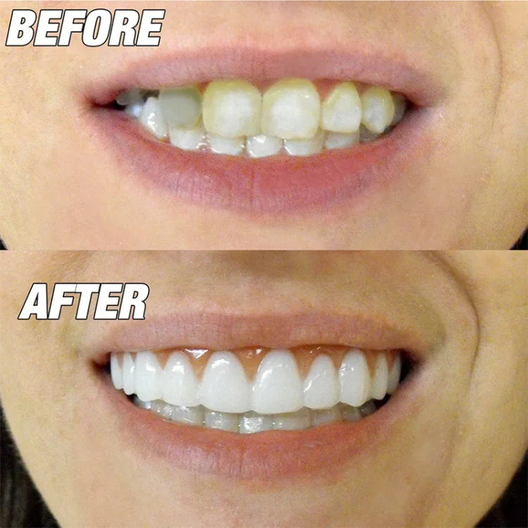Ferramenta de Beleza para Dentes Falsos, Sorriso Instantâneo, Ajuste Confortável, Capa Flexível para Dente Falso