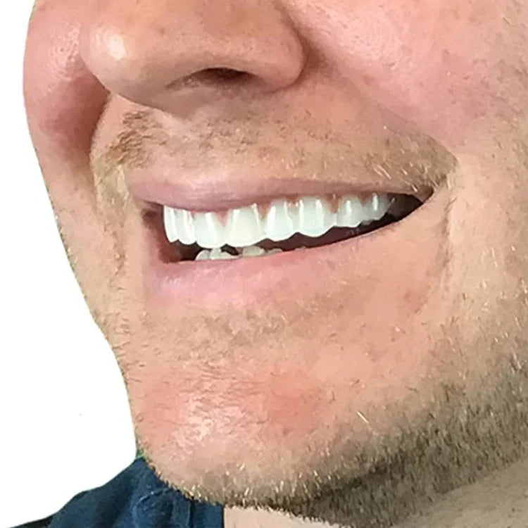 Ferramenta de Beleza para Dentes Falsos, Sorriso Instantâneo, Ajuste Confortável, Capa Flexível para Dente Falso