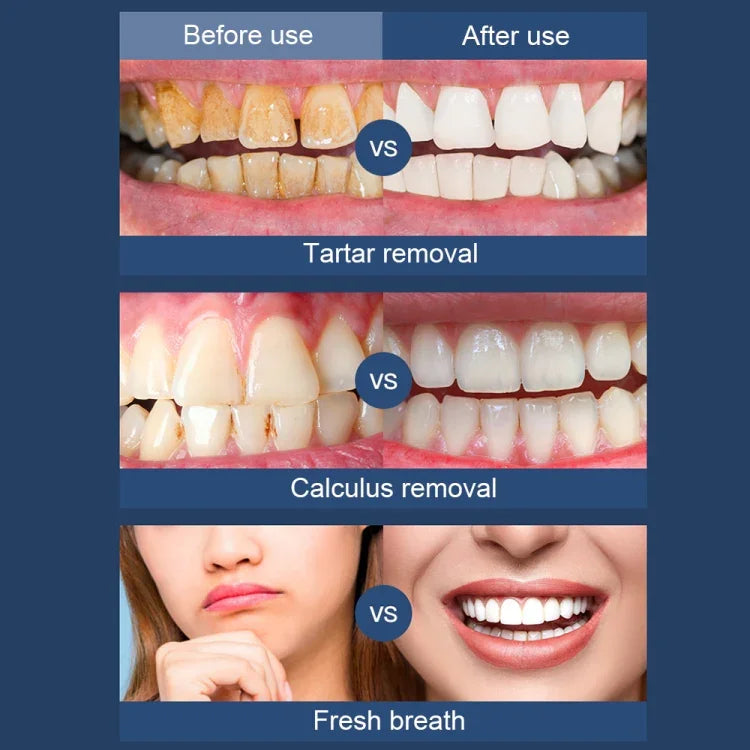 Escalador Elétrico Ultrassónico para Limpeza Dentária Doméstica, Instrumento Portátil de Descalcificação