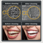 Escalador Dentário Elétrico Ultrassónico para Limpeza de Placa e Remoção de Tártaro com Luz LED, Pacote A, Pacote B, Pacote A com Acessórios, Pacote B com Acessórios