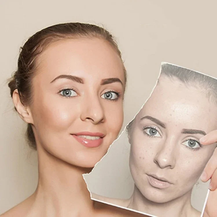 2 Peças Máquina Profissional Ultrassónica para Cuidados Faciais Femininos, Clareamento, Remoção de Sardas e Anti-envelhecimento